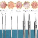 Ultra-fine Beauty Salon Acne Needle Tool Set - 8 pcs